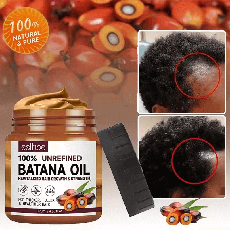 Batana Boost – Croissance & Force Capillaire CI