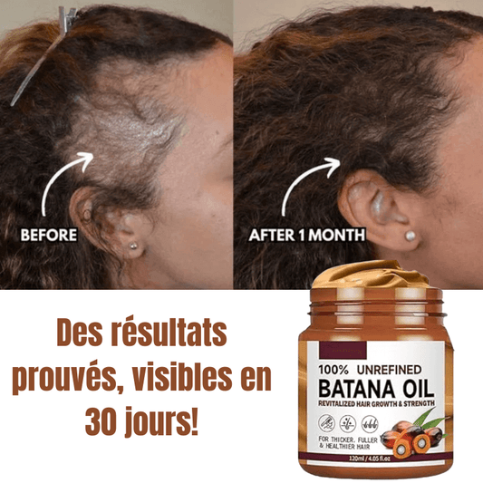 Batana Boost – Croissance & Force Capillaire CI