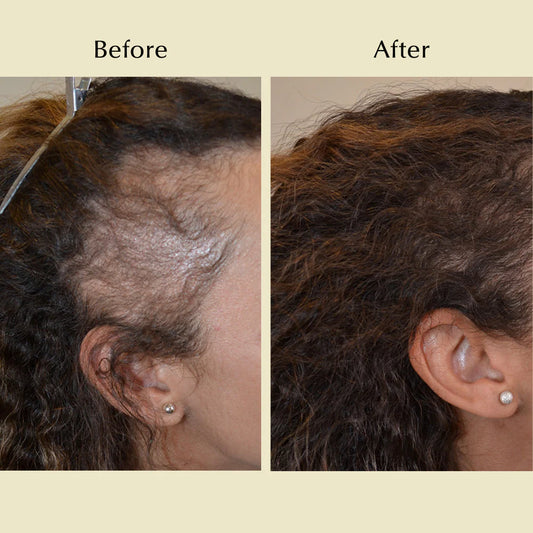 Huile de croissance capillaire naturelle BF