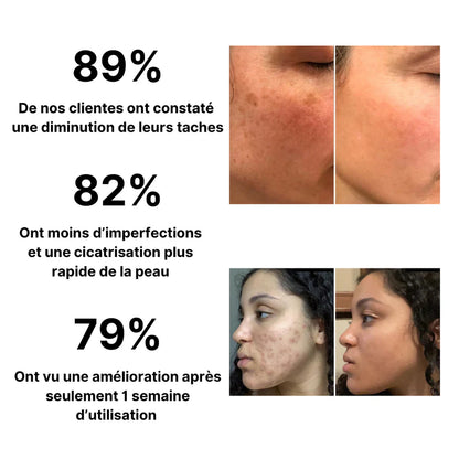 Crème Anti-Imperfections au Collagène BF