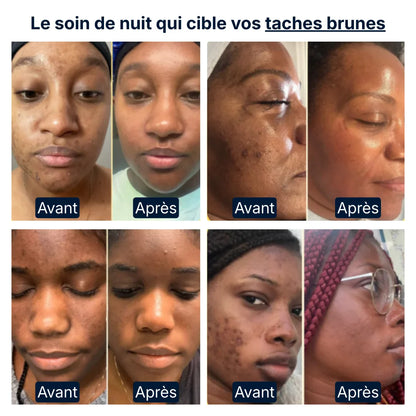 Masque de Nuit Curcuma & Kojic CI