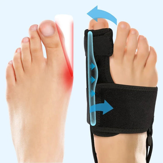 Correcteur d’orteils Hallux Valgus BF