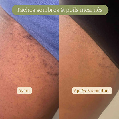 Lame de Douceur® Tête double anti-irritation CI