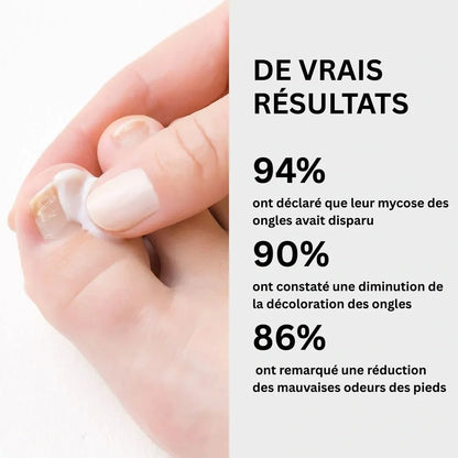 Gel contre les mycoses des ongles CMD