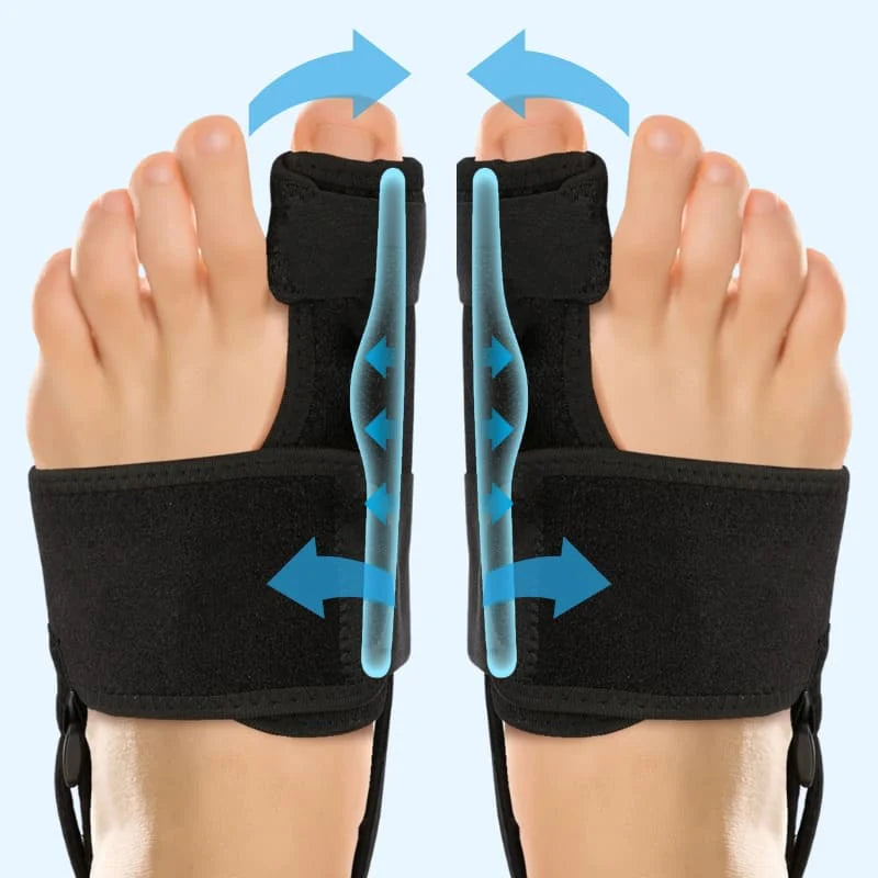 Correcteur d’orteils Hallux Valgus CI