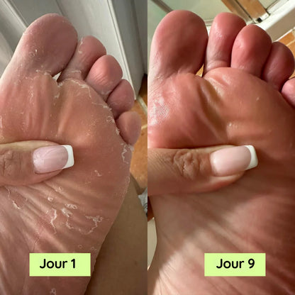 Savon anti-mycoses apaisant ML