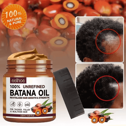 Batana Boost – Croissance & Force Capillaire CI