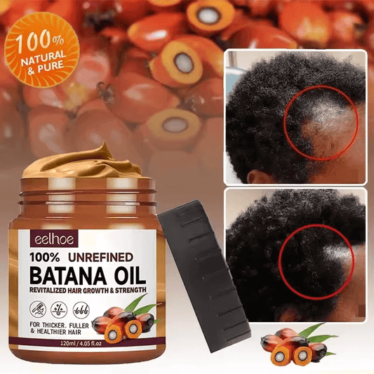 Batana Boost – Croissance & Force Capillaire CI