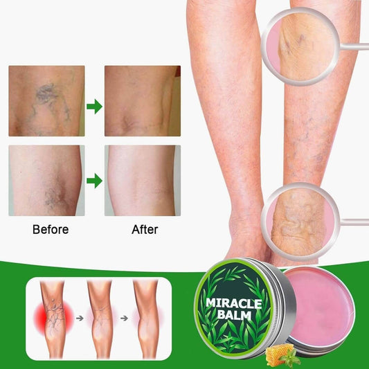 Baume Miracle Anti-Douleur & Anti-Varices BF