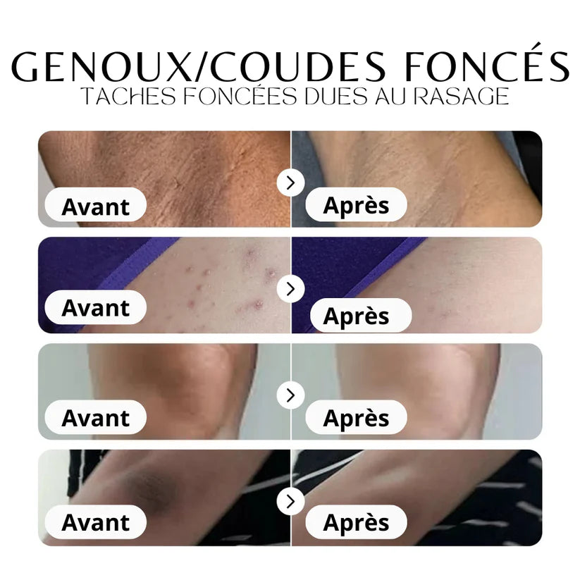 Crème Anti-Imperfections au Collagène BF