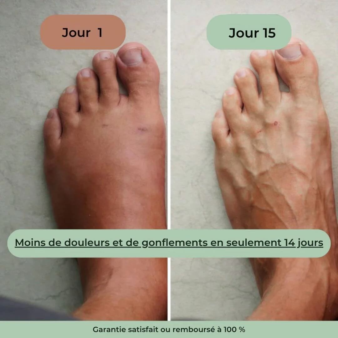 Masseur Thérapeutique Anti-Douleur NG