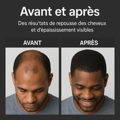 Shampoing activateur de racines CI
