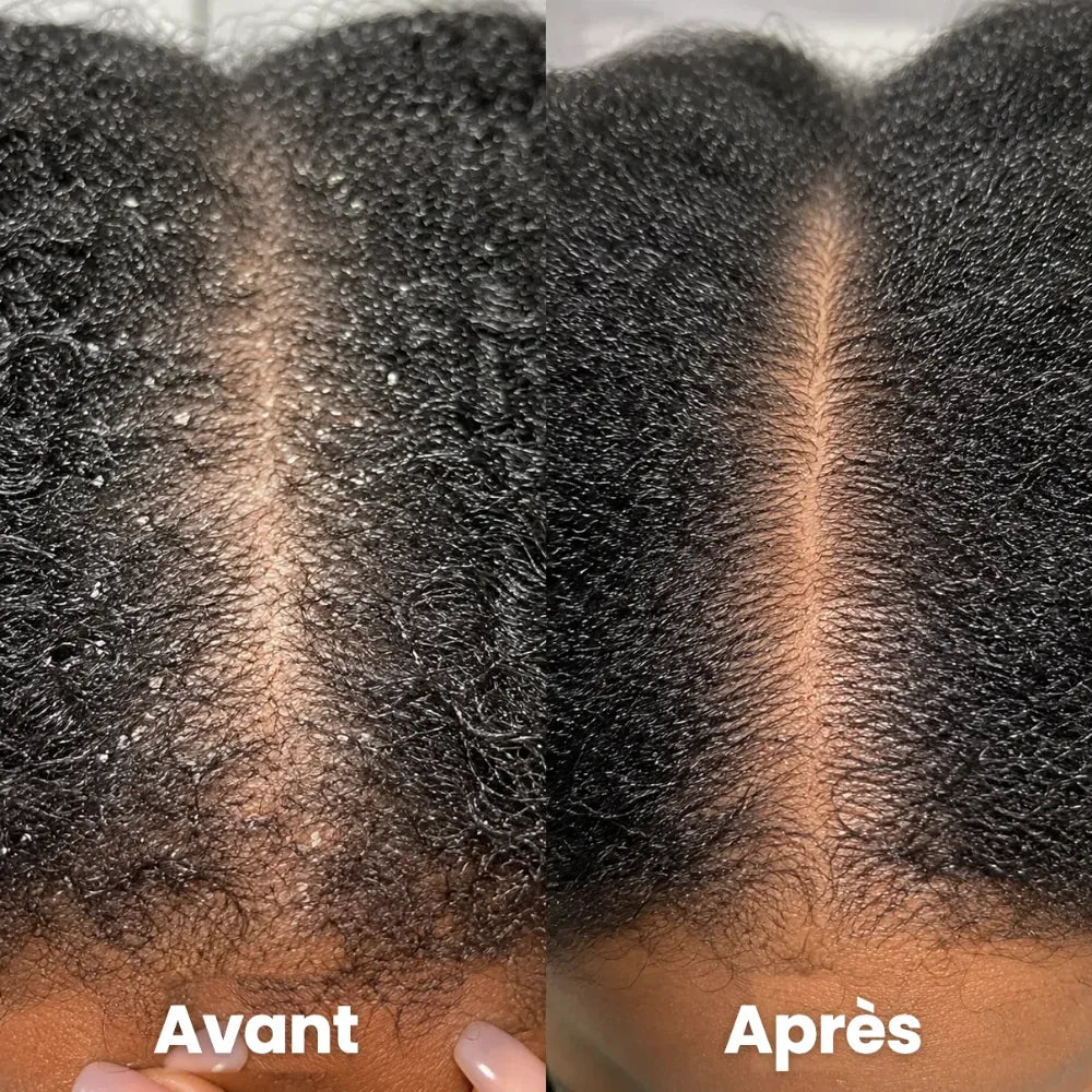 Crème Apaisante Cuir Chevelu CI