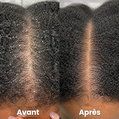 Crème Apaisante Cuir Chevelu CI